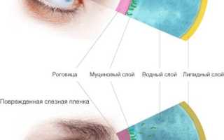 Синдром сухого глаза чем закапывать
