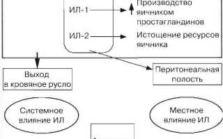 Асцит при синдроме гиперстимуляции яичников