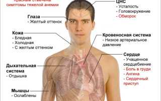 Миелодиспластический синдром в анализе крови