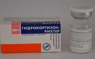 Народные средства при туннельном синдроме
