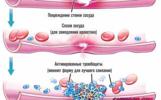 Заболевания сосудов с геморрагическим синдромом