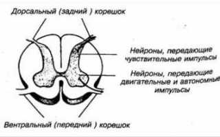 Остеохондроз с корешковым синдромом как лечить