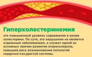 Холестиома код по мкб 10