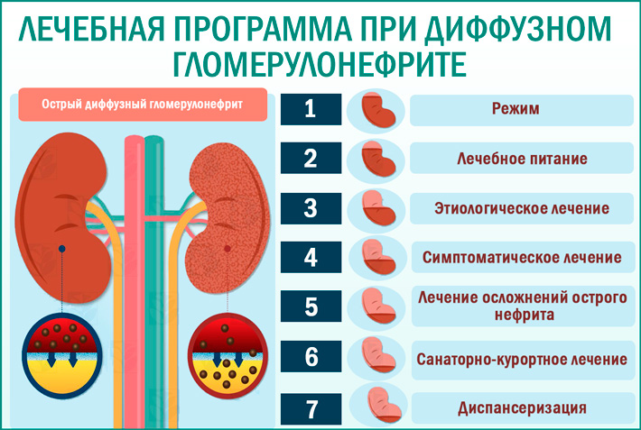 Гломерулонефрит: лечение