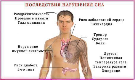 Опасность недостатка сна